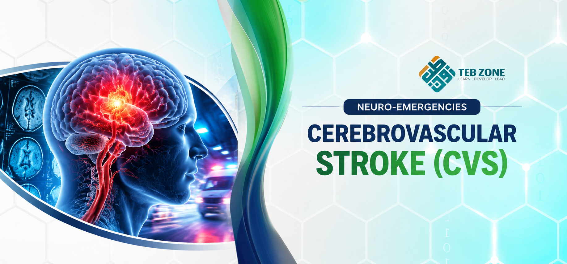 Neuro-Emergencies _ Cerebrovascular stroke (CVS)