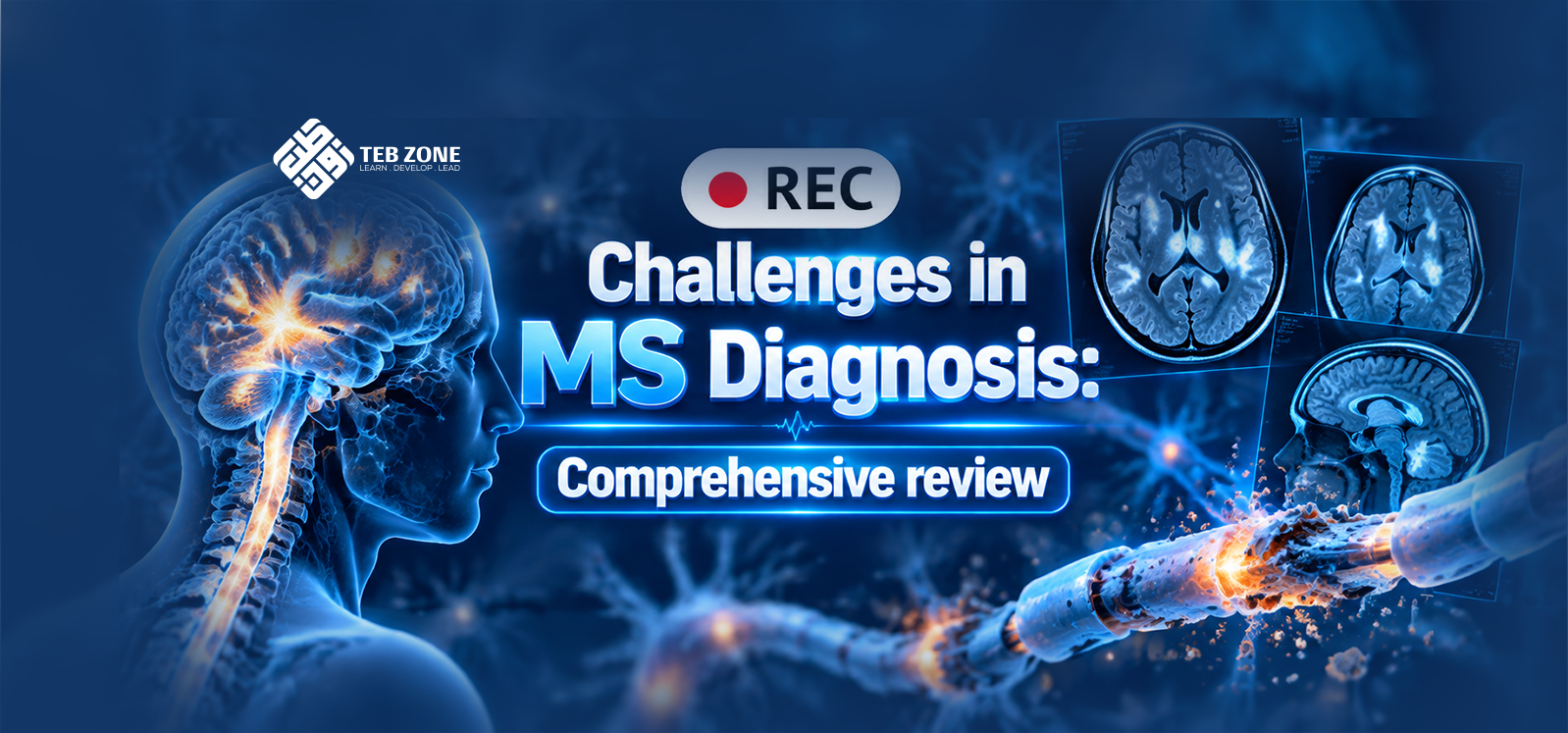 Challenges in MS Diagnosis: Comprehensive review
