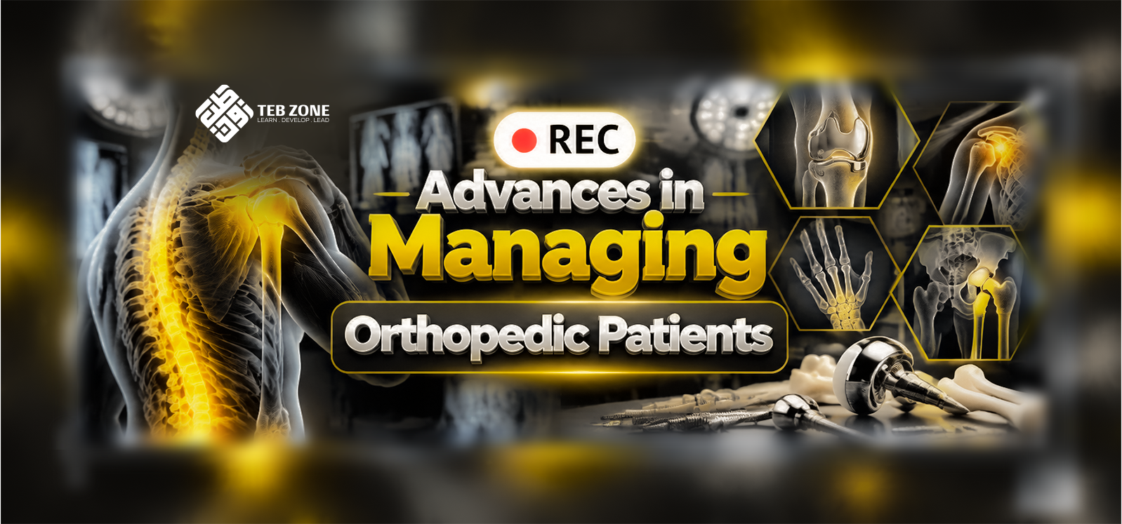 Advances in Managing Orthopedic Patients