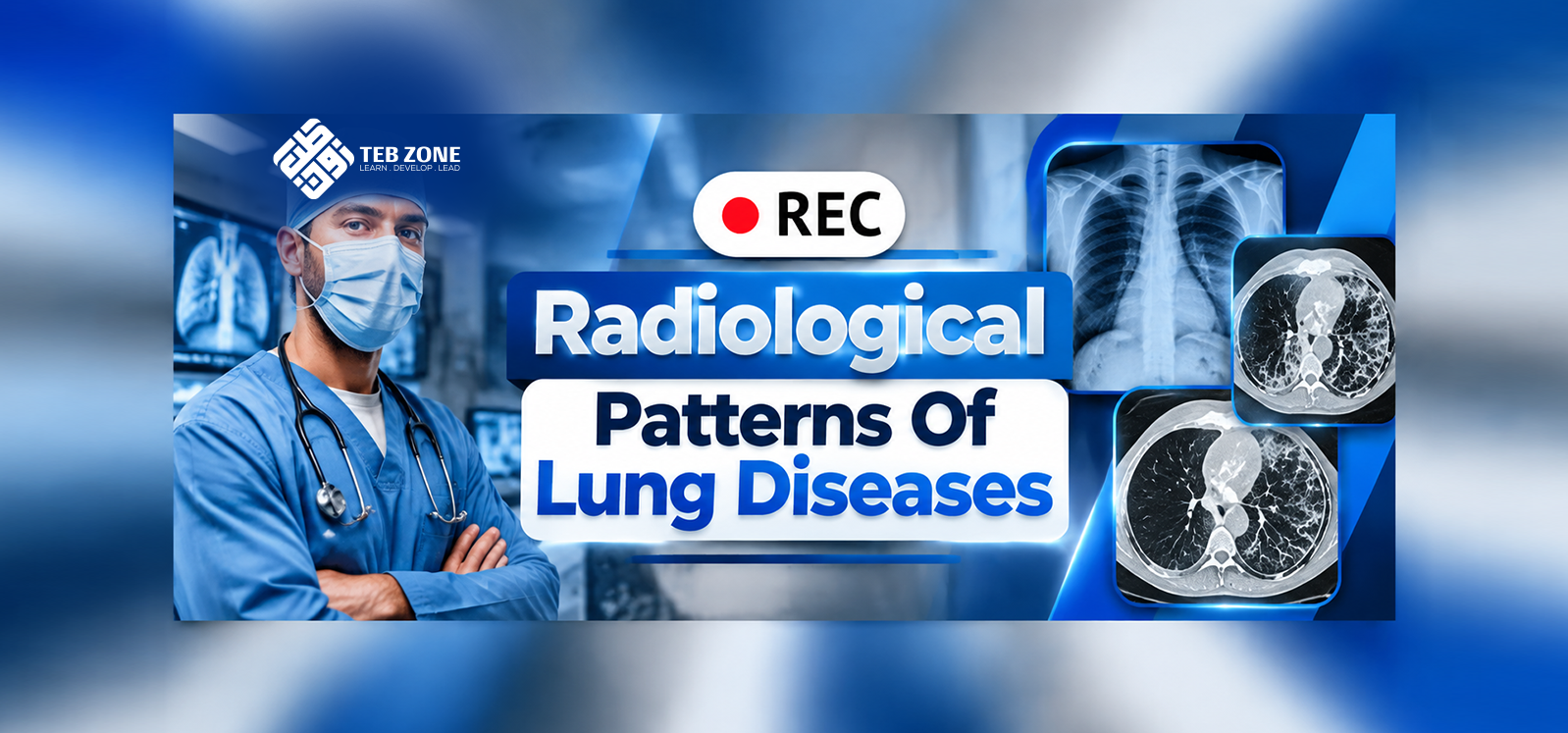 Radiological Patterns Of Lung Diseases